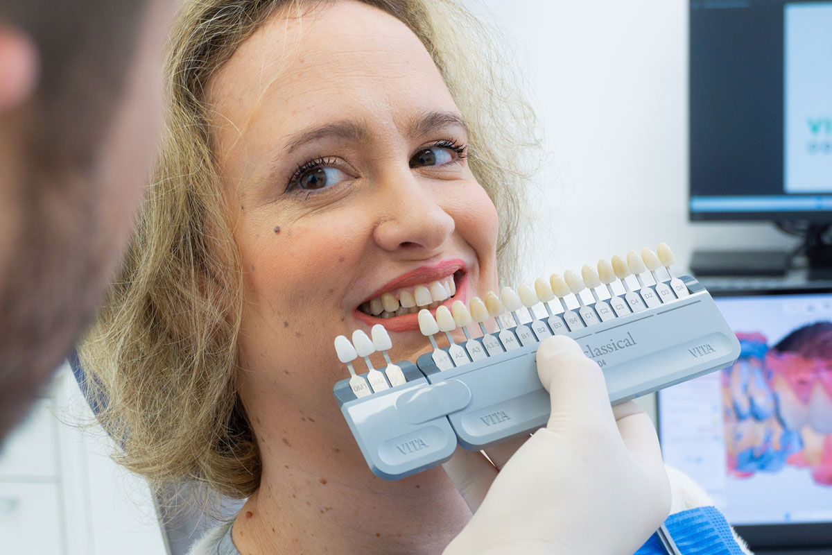 Paziente sceglie il colore delle faccette che applicherà al suo sorriso